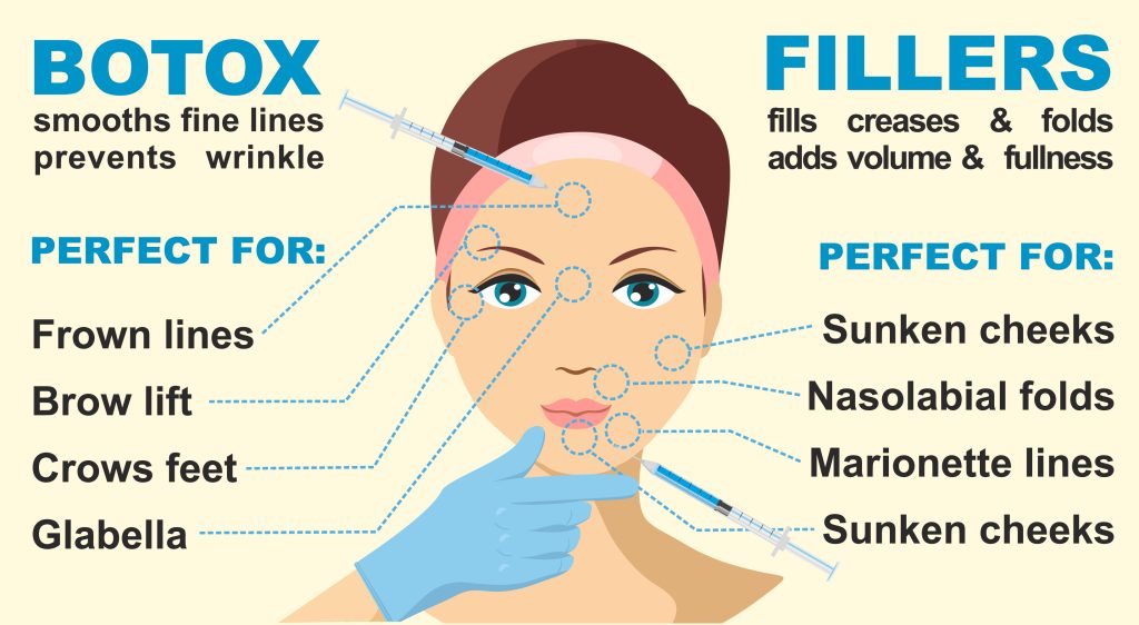 botox vs fillers